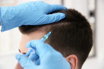 Young man with hair loss problem receiving injection on blurred background, closeup